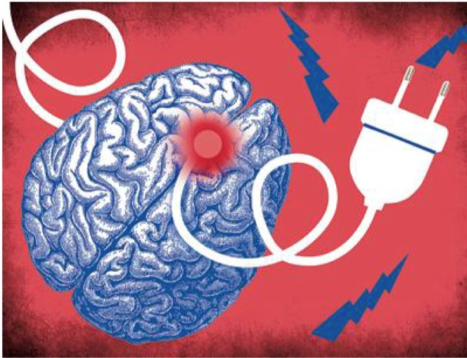Neurosciences : Stimuler la mémoire par des stimulations cérébrales non-invasives